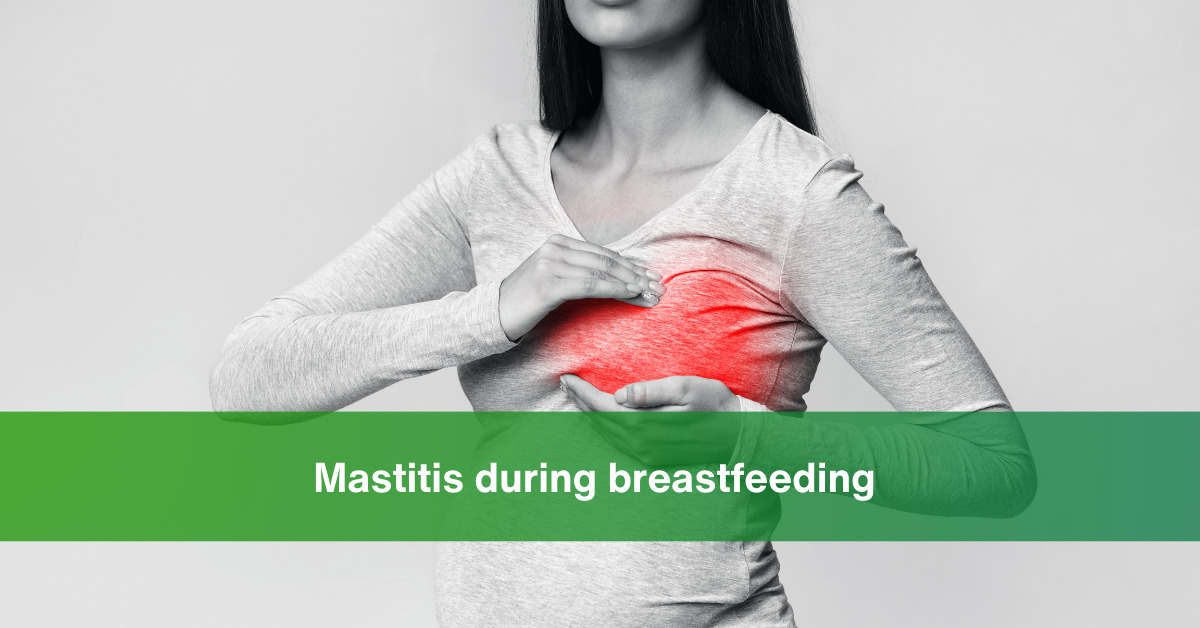 Why you should know about Mastitis during Breastfeeding