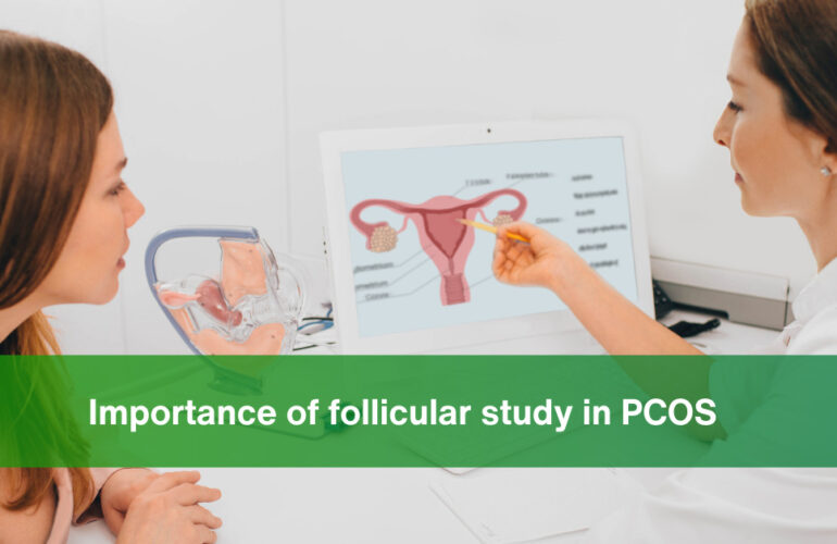 Importance of Follicular Study in PCOS