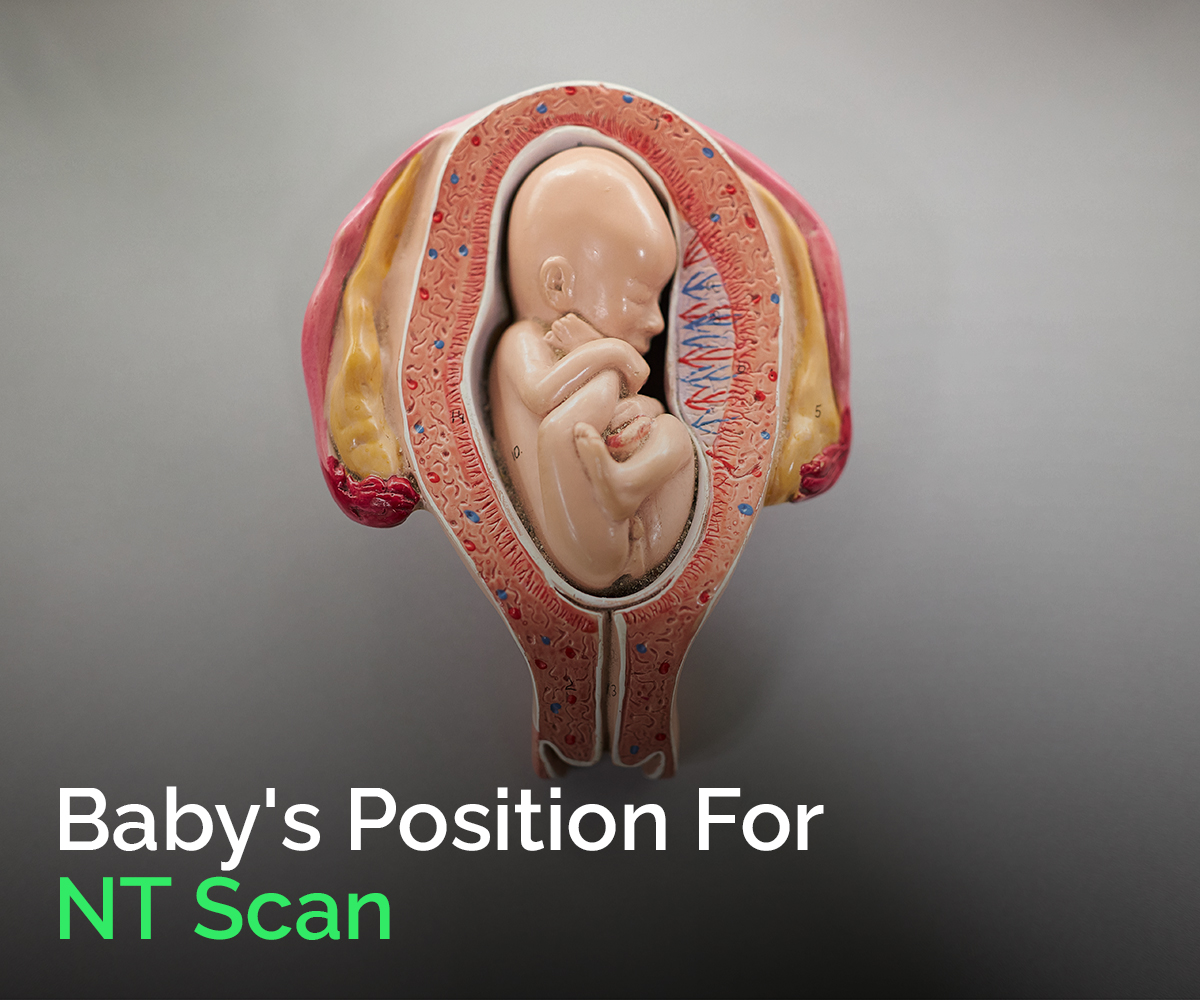 Baby's Position For NT Scan