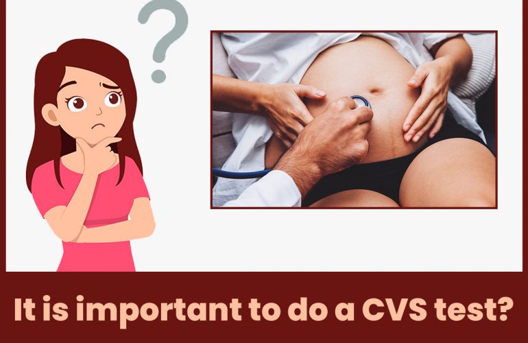 Is it important to do a CVS test