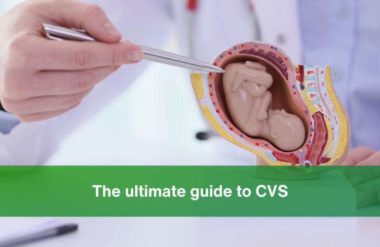 the ultimate guide to cvs