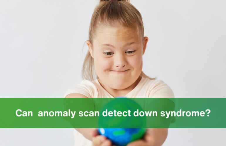 can anomaly scan detect down syndrome