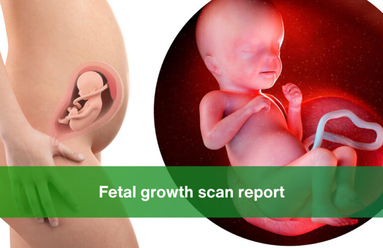 fetal growth scan report