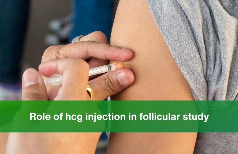 Role of hcg injection in follicular study