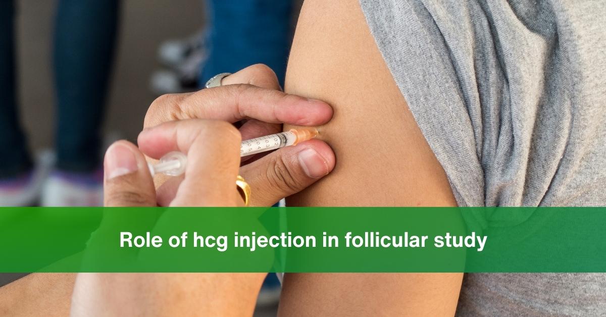Role of hcg injection in follicular study