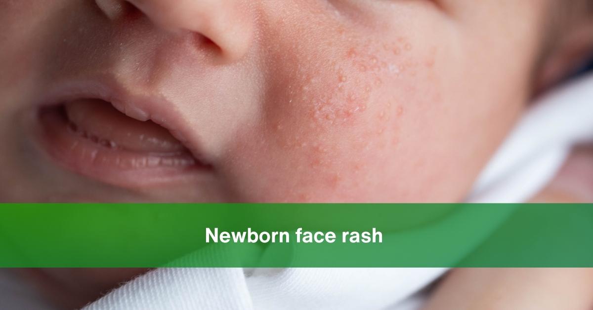 newborn face rash