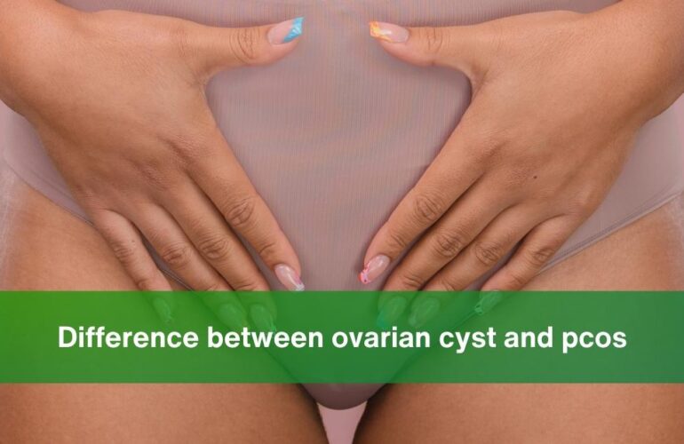 difference between ovarian cyst and pcos